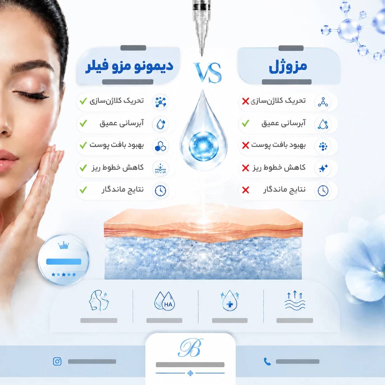 تفاوت مزوژل ها با مزوفیلر دیمونو